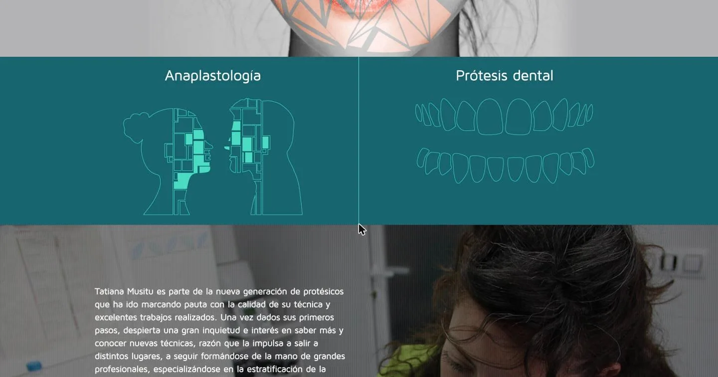 Accesos a anaplastología y prótesis dental con su iconografía