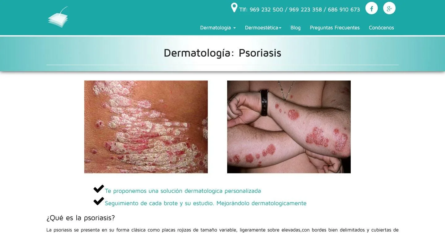 Página de psoriasis con fotografías de caso y explicación clínica